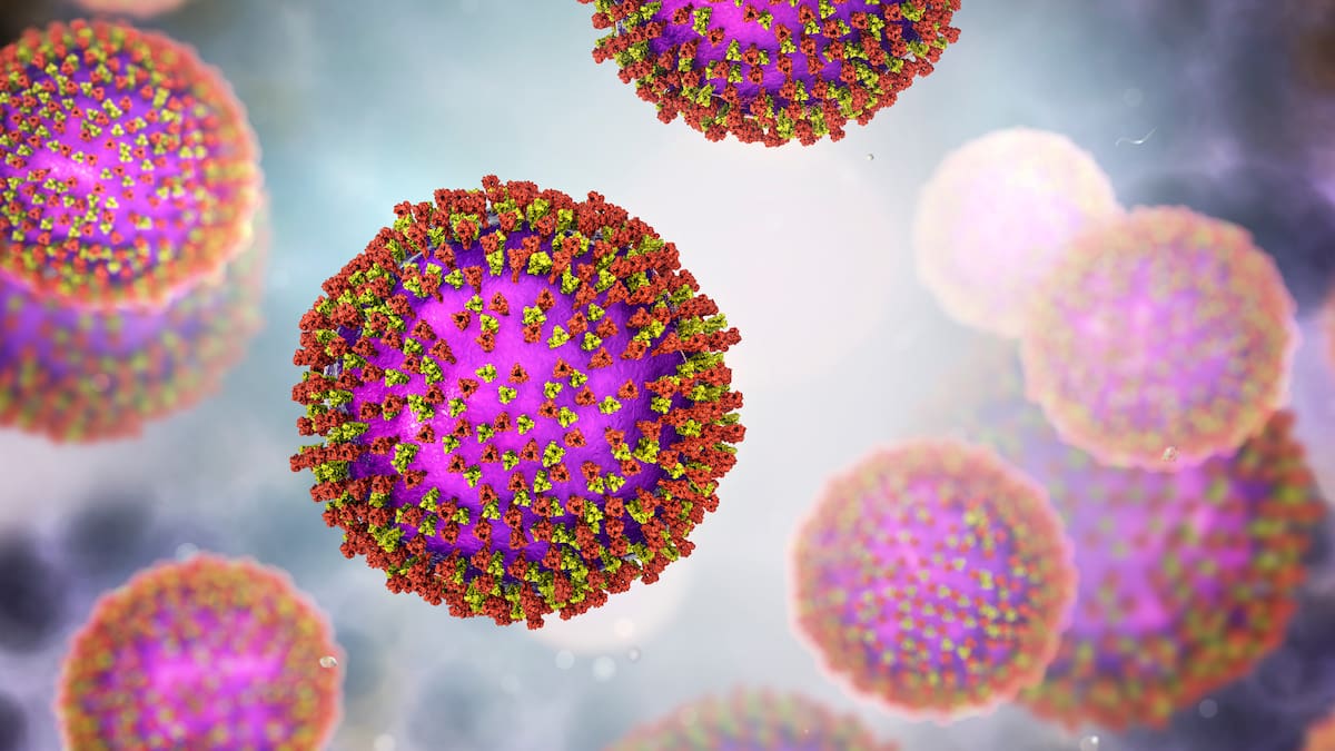 Measles Exposure: Updated Auckland Supermarket & Chemist List